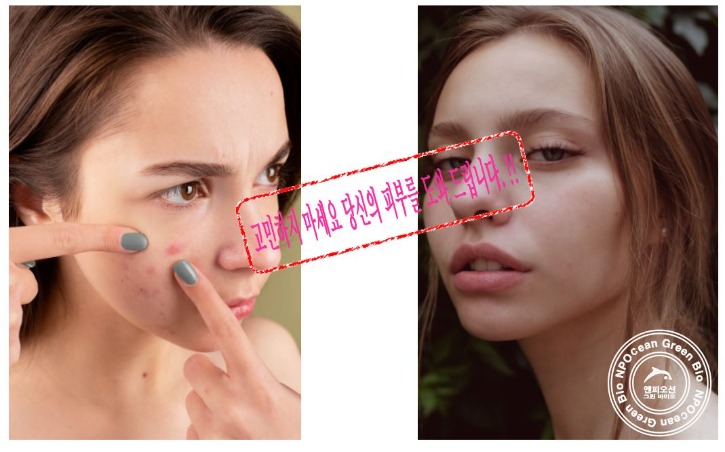 고민하지 마세요.JPG